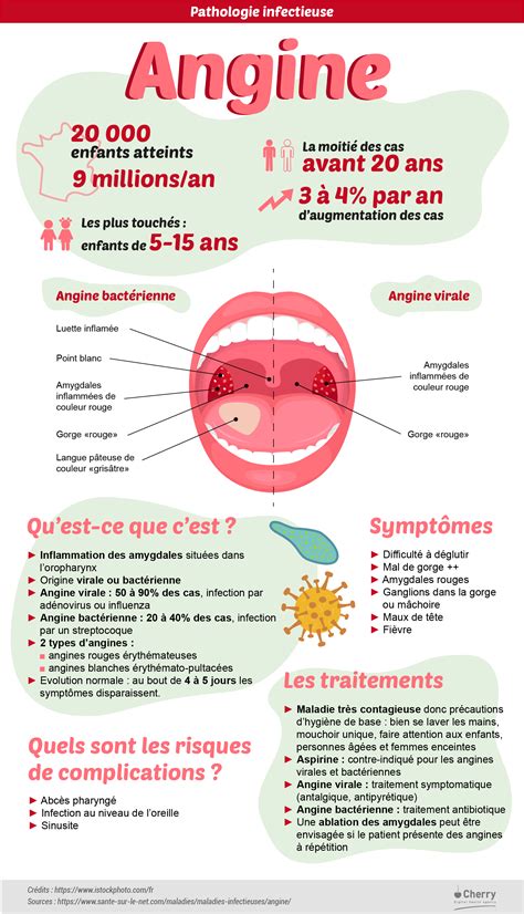 Angine virale bactérienne symptômes prévention traitements