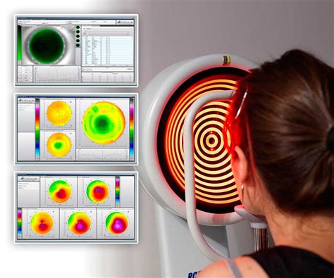 Topografía corneal Óptica Molina