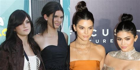 Kendall And Kylie Jenner Plastic Surgery Telegraph