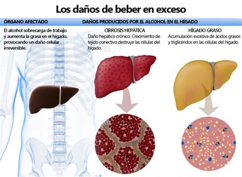 Graves Efectos Que Causa El Alcohol En El Organismo