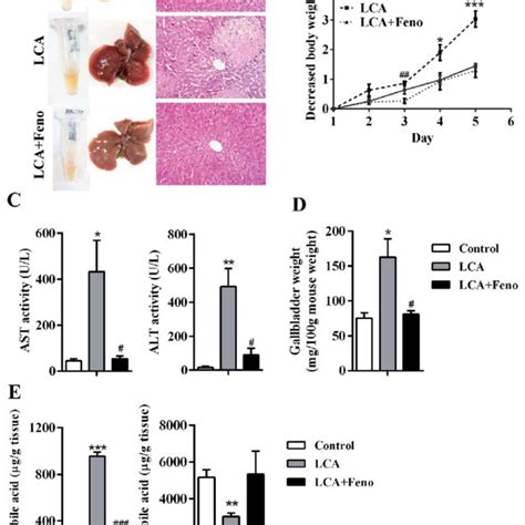 Fenofibrate Attenuated Lca Induced Liver Injury A Phenotype Of Serum