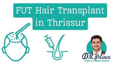 Comprehensive Guide To Fut Hair Transplant In Thrissur Topplasticsurgery