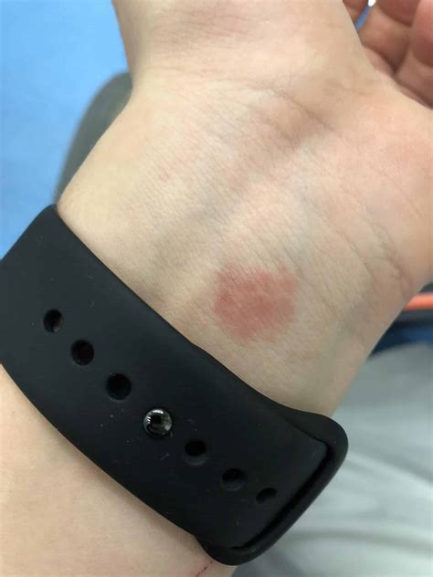 Apple Watch Random Vibrations: Causes, Fixes, and Prevention - GadgetMates