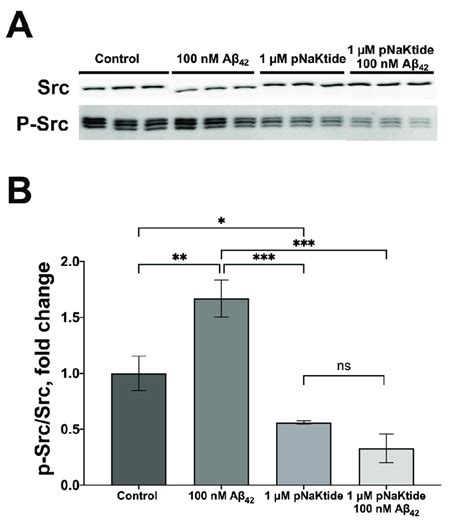 pNaKtide prevents Aβ42 induced activation of Src kinase SH SY5Y cells