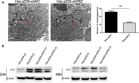 Chlamydia Trachomatis Induces P Dependent Autophagy In Hela Cells