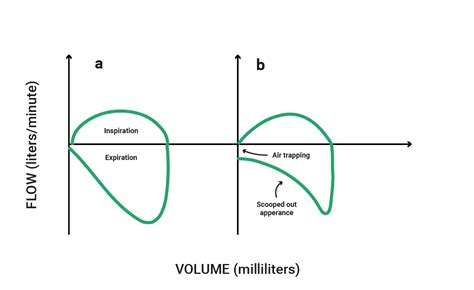 Flow Volume Loop Ventilator