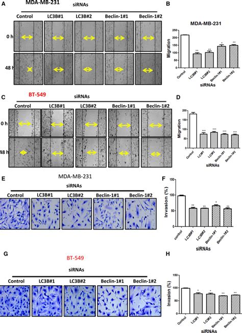 Effect Of Autophagy Inhibition On Migration And Invasion Of Tnbc Cells