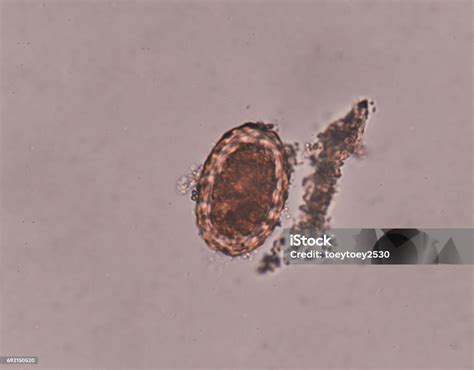 Parasit Ascaris Lumbricoides Telur Dalam Ujian Tinja Foto Stok Unduh Gambar Sekarang Istock