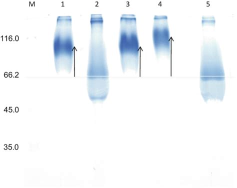 Analysis Of Protein Glycation Using Phenylboronate Acrylamide Gel Electrophoresis Springer