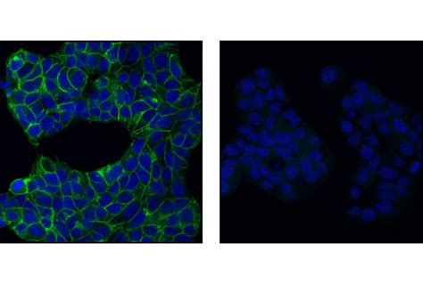 E Cadherin Antibody Cell Signaling Technology