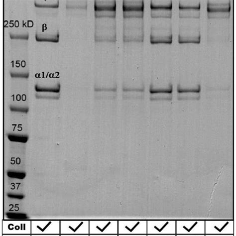 Electrophoretic Analysis Of Age Inhibitors 9 G Collagen Lane Lane 1