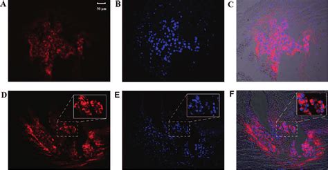 Histological Detection Of Cells Labeled With Rhodamine Containing