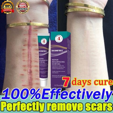 Dermfree Original Scar Removal Cream Scar Repair Gel Remover Acne