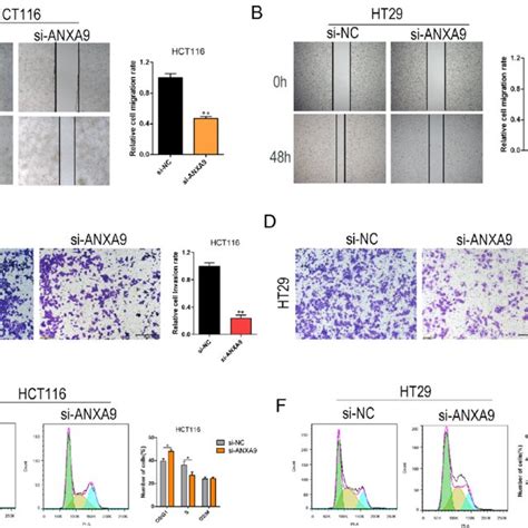 Anxa Knockdown Suppresses The Cell Migration Invasion And Cell Cycle