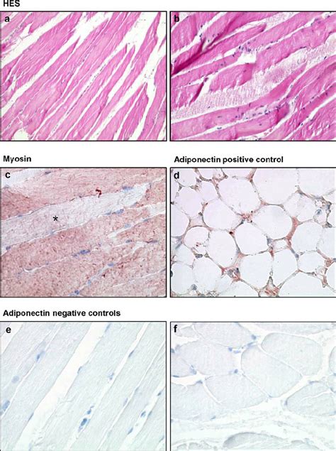 Hes And Myosin Staining In Muscle Of Obese Mice And Positive And