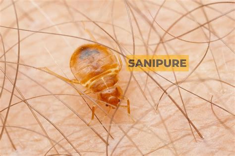 Comment reconnaître une morsure de punaise de lit SANIPURE