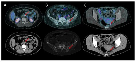 Cancers Free Full Text Prospective Multicentric Assessment Of 68ga