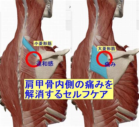 肩甲骨の内側のしこりや違和感、痛みを解消 東京、台東の治療院フィジカルメンテ癒楽