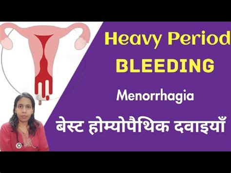 Heavy Menstrual Bleeding Menorrhagia Causes Best Homeopathic Medicines