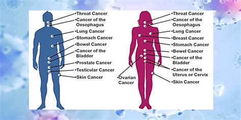 types  cancer target radiology