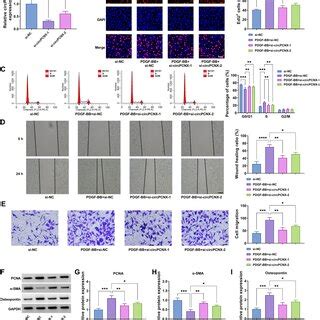 High Expression Of Circpcnx In Pdgf Bb Induced Ha Vsmcs A Volcano