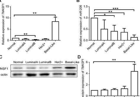 Upregulation Of TM4SF1 And Downregulation Of MiR 206 In Clinical Breast