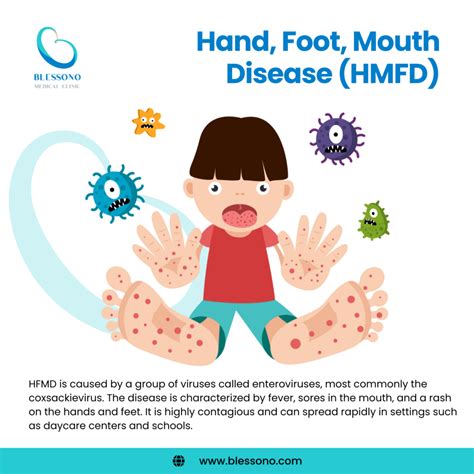 What Parents Need To Know About Hand Foot Mouth Disease HFMD