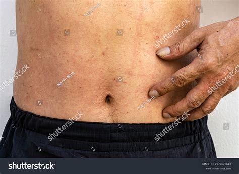 Stomach Sensitivity Over 1588 Royalty Free Licensable Stock Photos