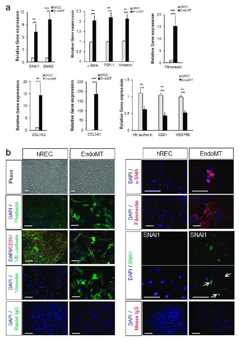 Primary Human Retinal Endothelial Cells Hrec Can Be Used To Model