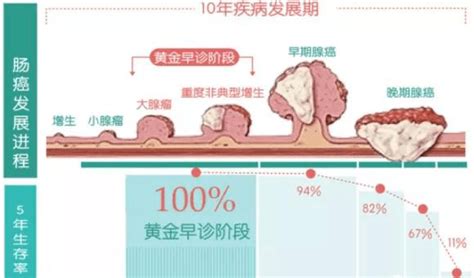 【惠民】结直肠癌无创筛查黑科技——粪便sdc2甲基化检测 人群 肿瘤 肠道