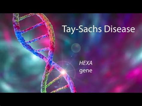 Tay Sachs Disease Chem Electra Biochemistry Inborn Errors Of