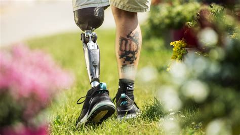 What To Know About Prosthetics