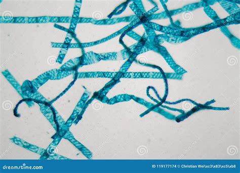 Spirogyra Alga Under the Microscope Stock Photo - Image of microscope ...