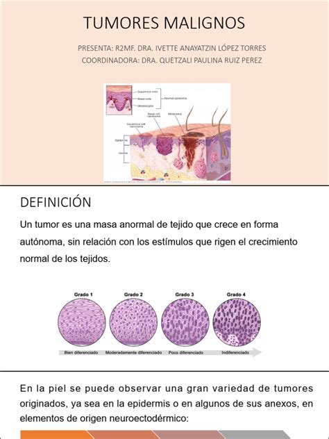 Tumores Malignos | PDF | Cáncer | Neoplasias