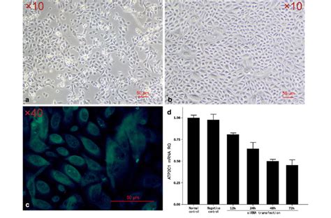 Normal Human Primary Epidermal Keratinocytes Were Cultured For 48 H A