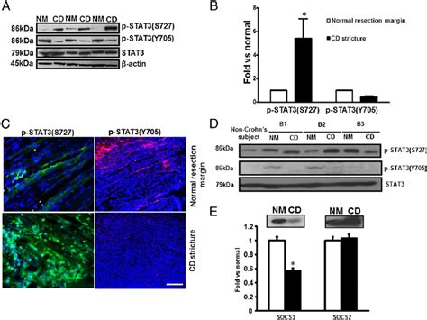 STAT3 S727 And STAT3 Y705 Are Differentially Phosphorylated And SOCS3