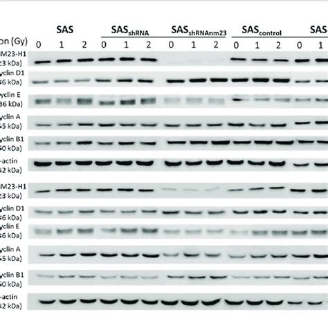 Western Blot Showing The Effect Of Nm23 H1 Expression On Cyclin D1