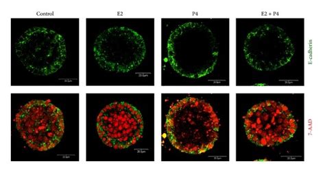 E Cadherin Localization In Acinar Structures Formed By Bme Uv1 Cells