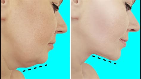 Say Goodbye To Your Double Chin And Excess Face Fat Slim Down Your Face