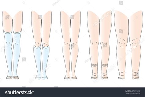 Legs There Is Edema, No Swelling Legs Stock Vector Illustration 276787232 : Shutterstock