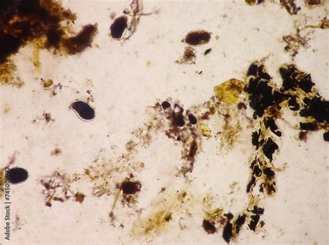 Giardia Lamblia Cysts And Trophozoite Form Muscle Fiber In Stool Examination Under 40x Light