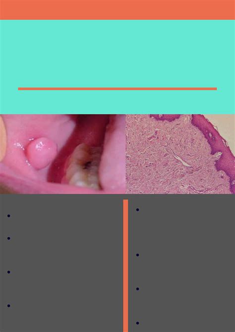 Tumores De Tecido Mole Patologia Bucal Patologia Bucal