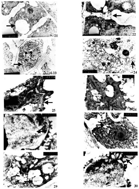 Electron Transmission Micrographs Of Cms Line Microsporogenesis And