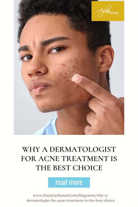 Why a dermatologist for acne treatment is the best choice – Artofit