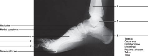 Solved Identify The Bones And Features Indicated In The Radiog