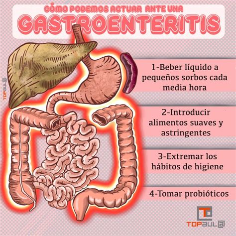 Infografía ¿cómo Podemos Actuar Ante Una Gastroenteritis Topaula