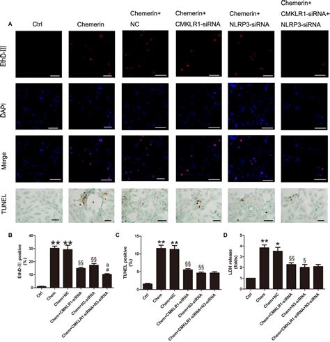 Frontiers Chemerin CMKLR1 Axis Promotes Inflammation And Pyroptosis