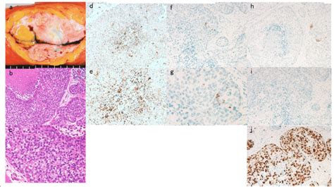 Macroscopic And Pathological Findings A Macroscopic Analysis Showing