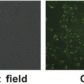 The Expression Of ObR B In Breast Cancer Cells Determined By Western