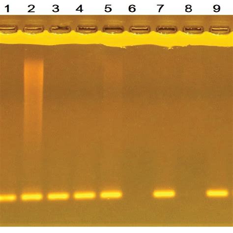 Agarose Gel Electrophoresis For Recn Amplicons Agarose Gel Download Scientific Diagram